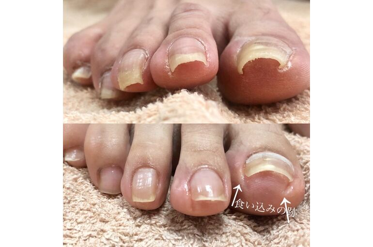 NICE NAIL天王寺店】ジェルネイル2,990円～《パラジェル取扱店》