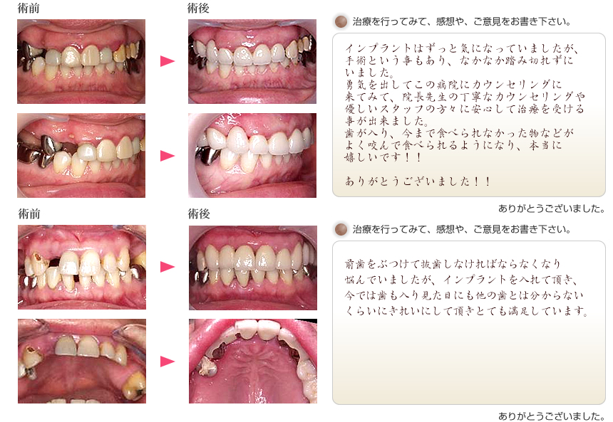 SMILE BASE CAFE 池袋店 على