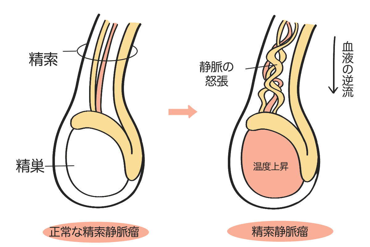 男性機能がみるみる改善する睾丸ほぐし健康法　腰痛改善　頻尿改善　性欲向上　気力充実