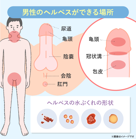 腟がゆるい」腟内にお湯や空気が入るなど腟のゆるみの原因・対策を女医が丁寧に徹底解説。 –  港区、品川区の産婦人科で妊婦健診・産後ケア・避妊相談なら│海老根ウィメンズクリニック