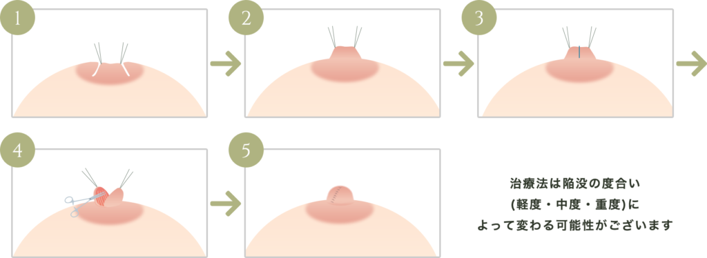 ふっくらとした乳首、((([目を閉じた: (虚ろな目:1.3):11], , (涙:0.6),