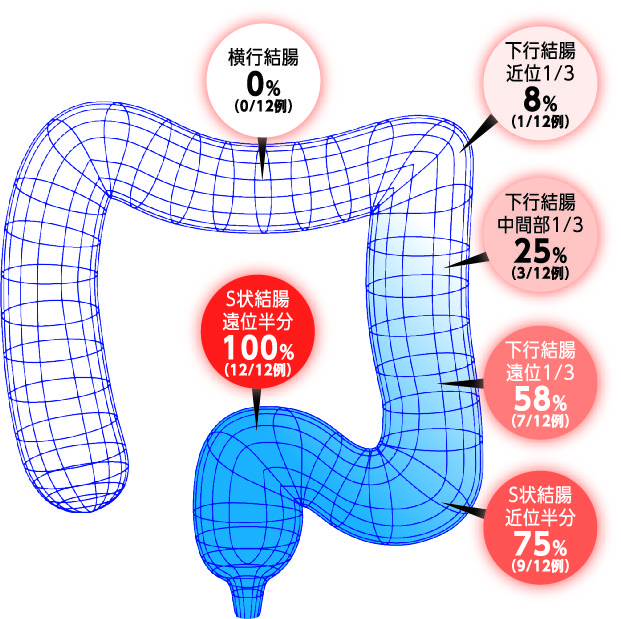 新型大腸内視鏡モデル-mikoto- : 水浸法による無痛大腸内視鏡挿入マニュアル