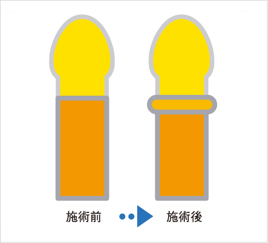 コックリングとは？｜ペニスリングとは？｜ コックリングの種類 ｜ 信長トイズまとめブログ