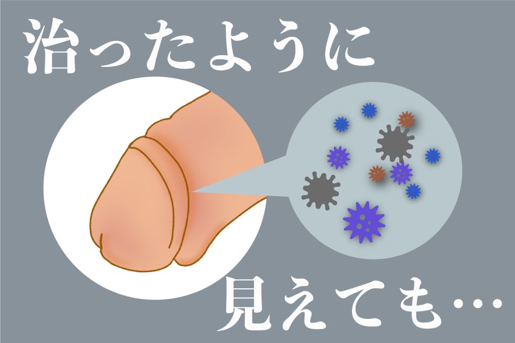 ペニスを大きくする方法は？増大サプリや器具、オナ禁の効果も解説 | 包茎手術のノーストクリニック【公式】