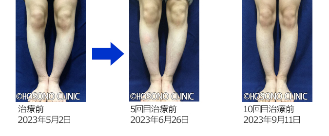 歩行動作の基礎知識 - 歩行周期