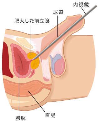 前立腺マッサージのやり方をポイント・コツ｜注意点もあわせて解説！ – 東京で稼げる！風俗求人は【夢見る乙女グループ】│