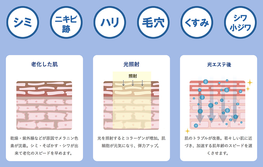 男性もエスプリで！メンズエステコースをご紹介します（ビフォーアフター画像あり） エスプリニュース（詳細）｜銀座、新宿のエステサロン 痩身＆肌改善 