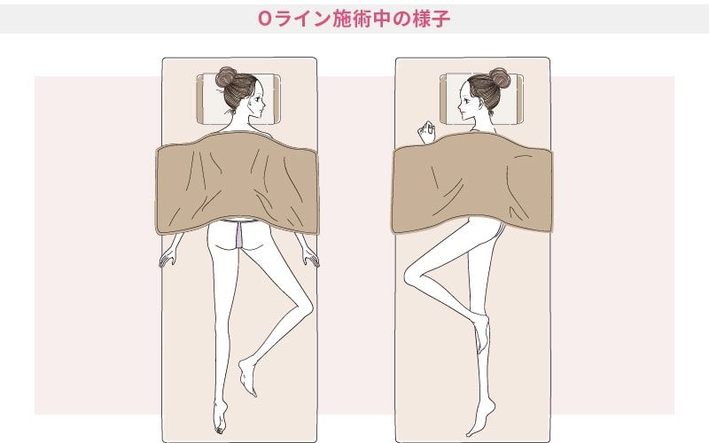 日本一可愛い脱毛スタッフの前でコレしなきゃいけないの？泣