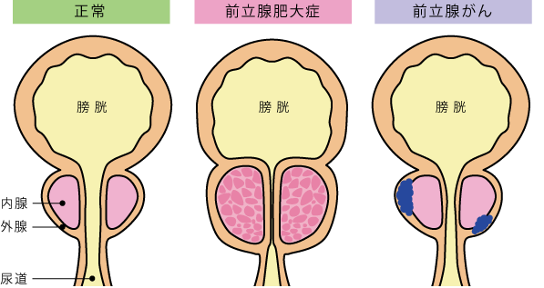 新たな快感の扉を開く！前立腺マッサージの方法｜エステの達人マガジン - 前立腺